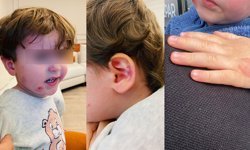 Gemlik’te özel kreşte 2,5 yaşındaki çocuk darp edildi!