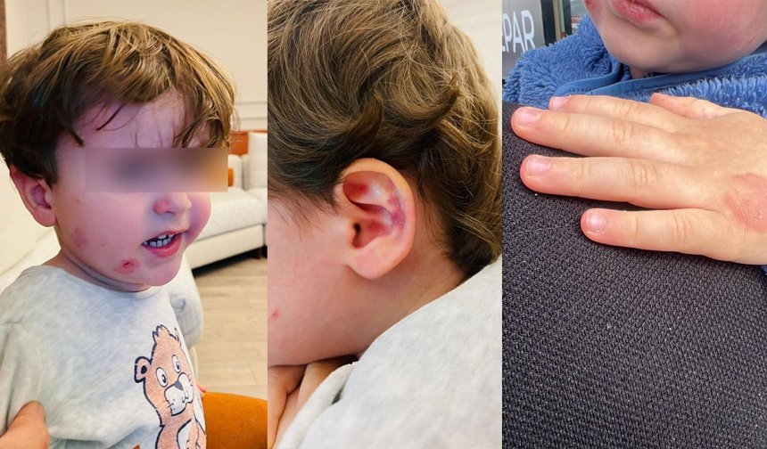 Gemlik’te özel kreşte 2,5 yaşındaki çocuk darp edildi!